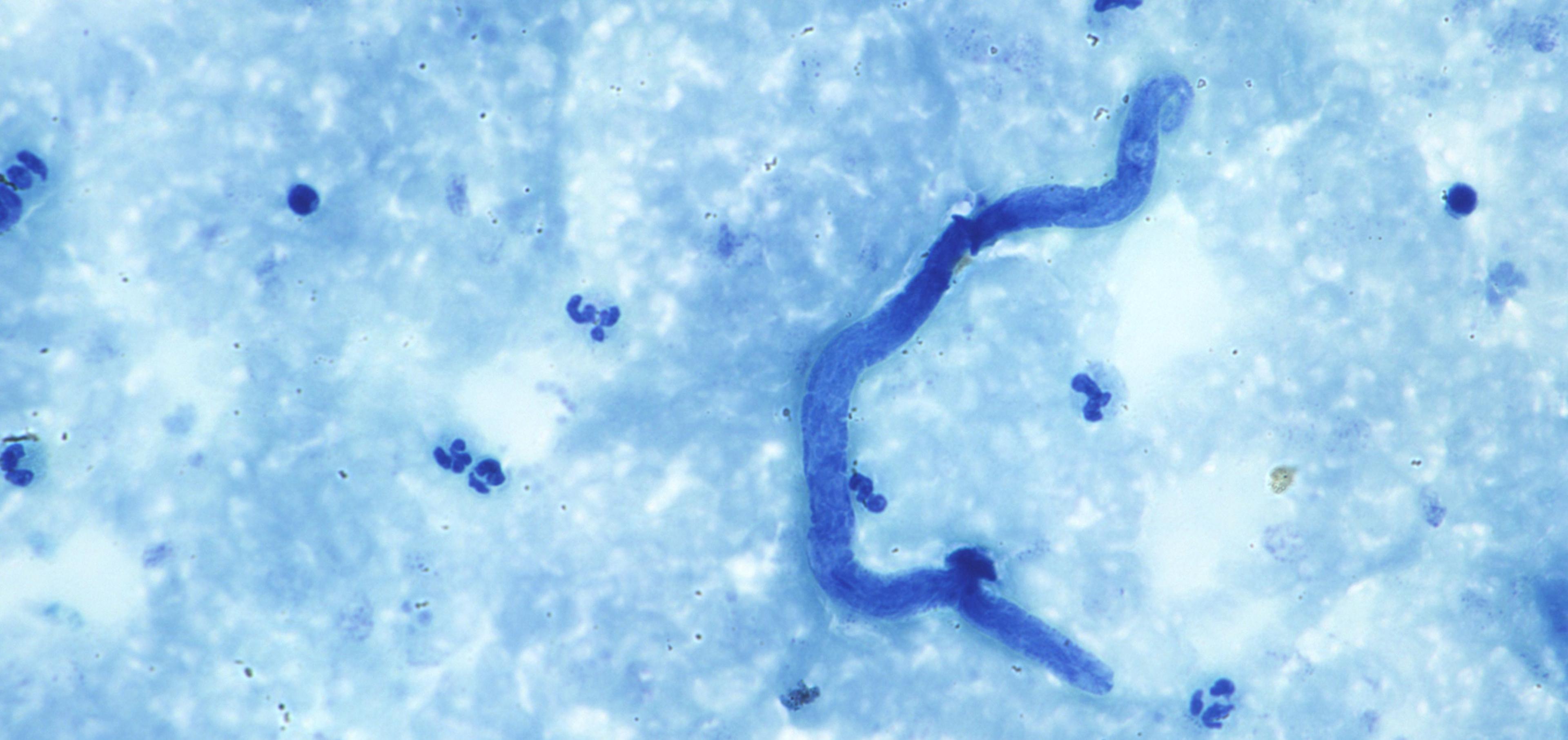 005 LoaLoa x 60 au field stain no1. Kopie.jpg