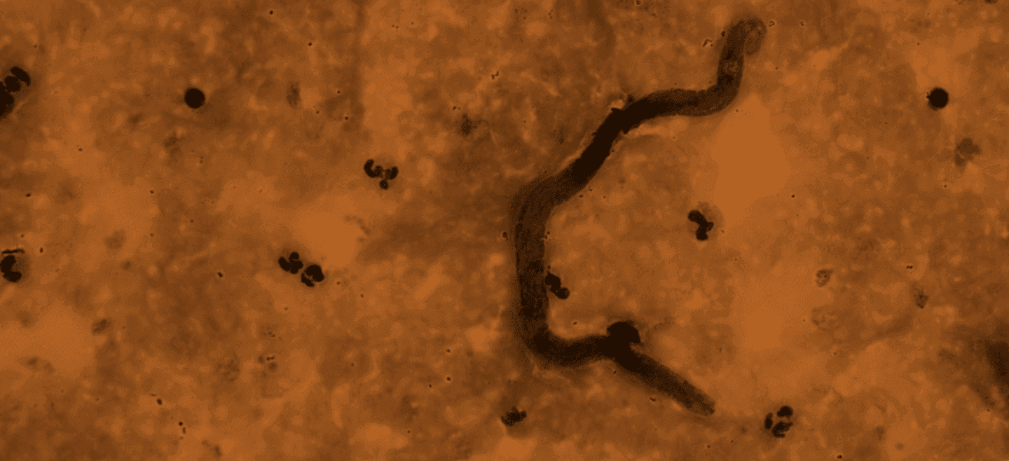 An grafic of the worm under the microscop with an amber colored background